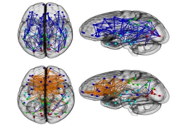 brain--621x414